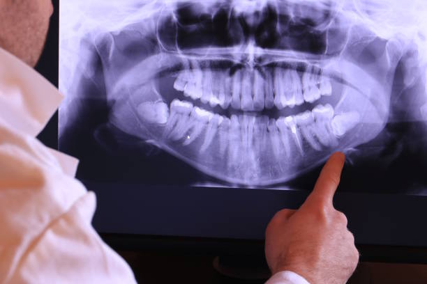 Best Tooth Infection Emergency Dentist  in North Hartsville, SC
